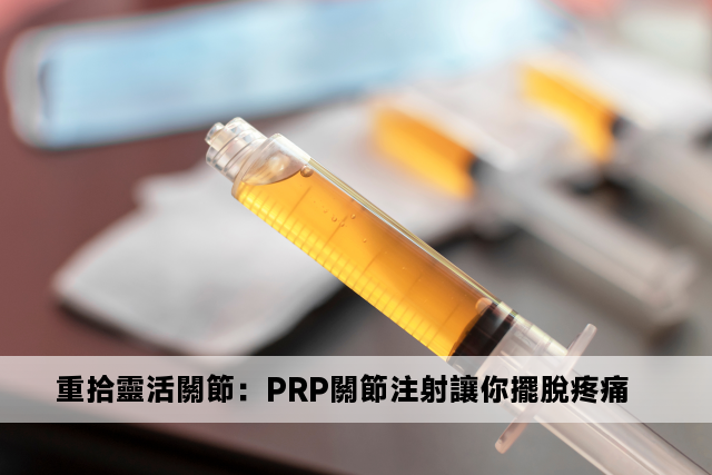 重拾靈活關節：PRP關節注射讓你擺脫疼痛